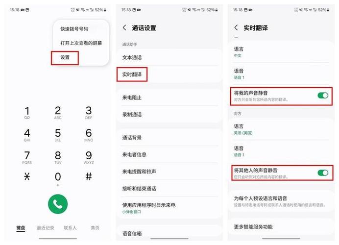 通话设置在哪