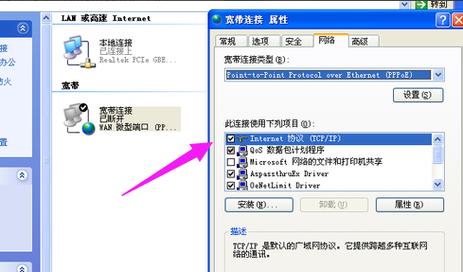 本地连接设置