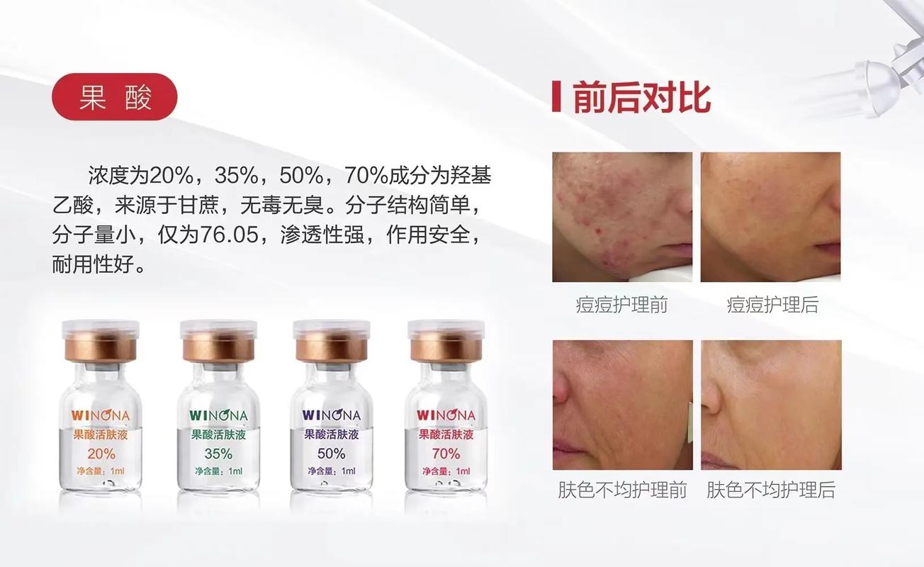 抖音换肤功能是什么