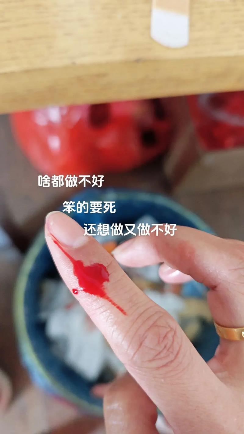 抖音晕血什么梗