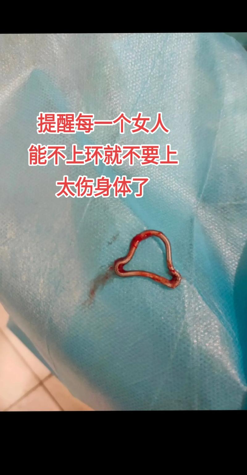 抖音为什么评论上环