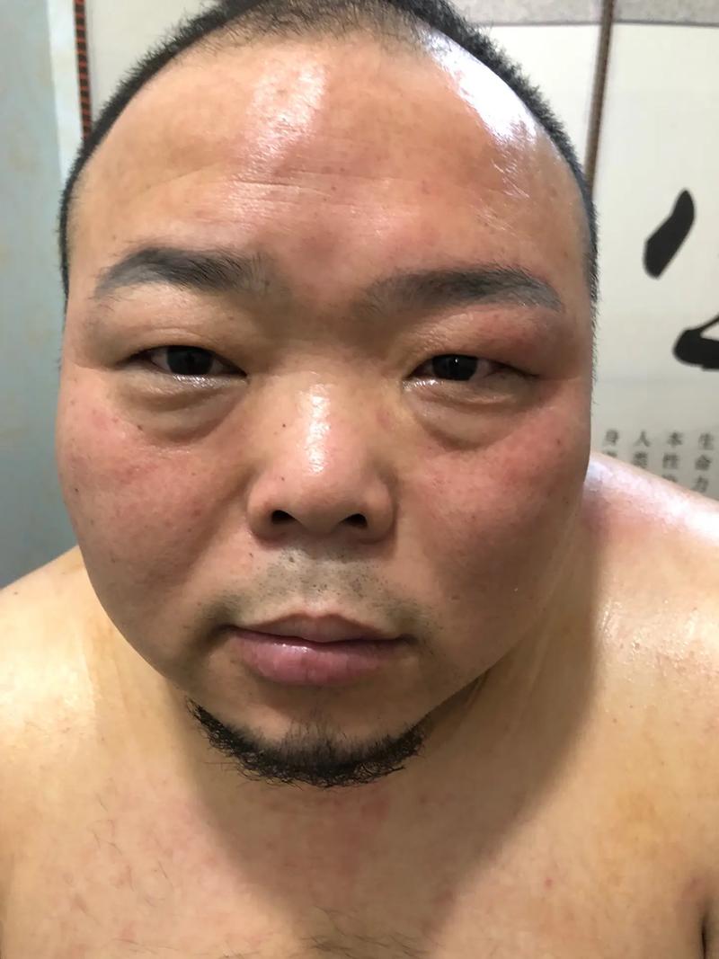 面瘫抖音号叫什么