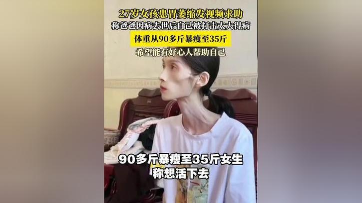 女孩患胃萎缩从90多斤暴瘦至35斤