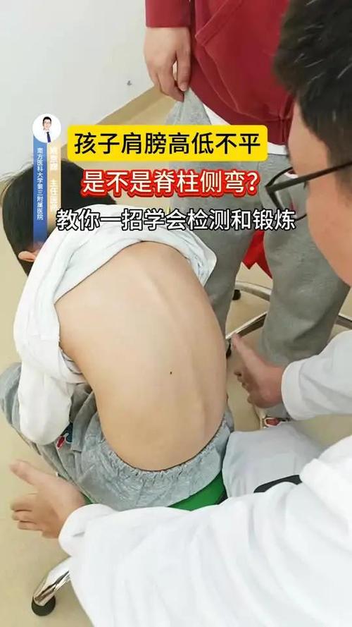 孩子“坐没坐相”可能是脊柱侧弯