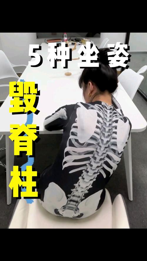 孩子“坐没坐相”可能是脊柱侧弯