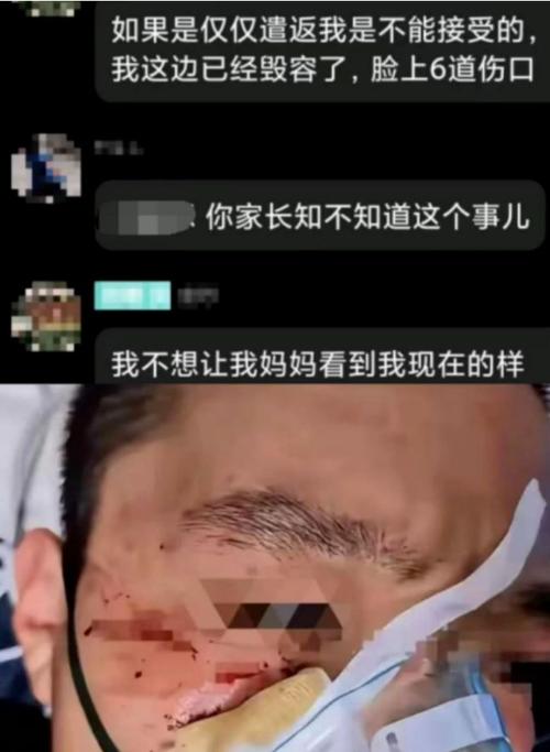 围殴中国留学生的嫌犯均被保释