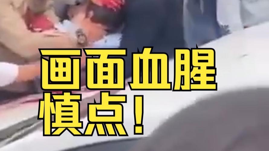 哥伦比亚遭枪击总统参选人去世