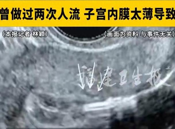女子5次试管后艰难怀孕却确诊肝癌