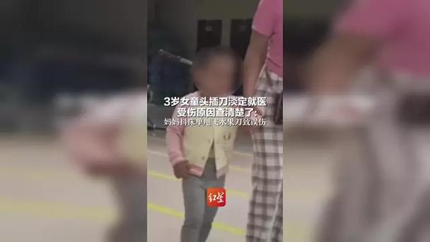 3岁女童头上插刀 系妈妈不慎刺入