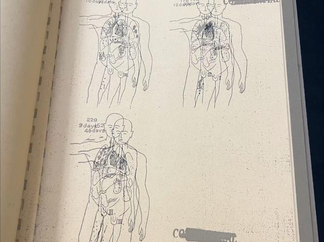 俄公布日本731部队细菌战解密文件