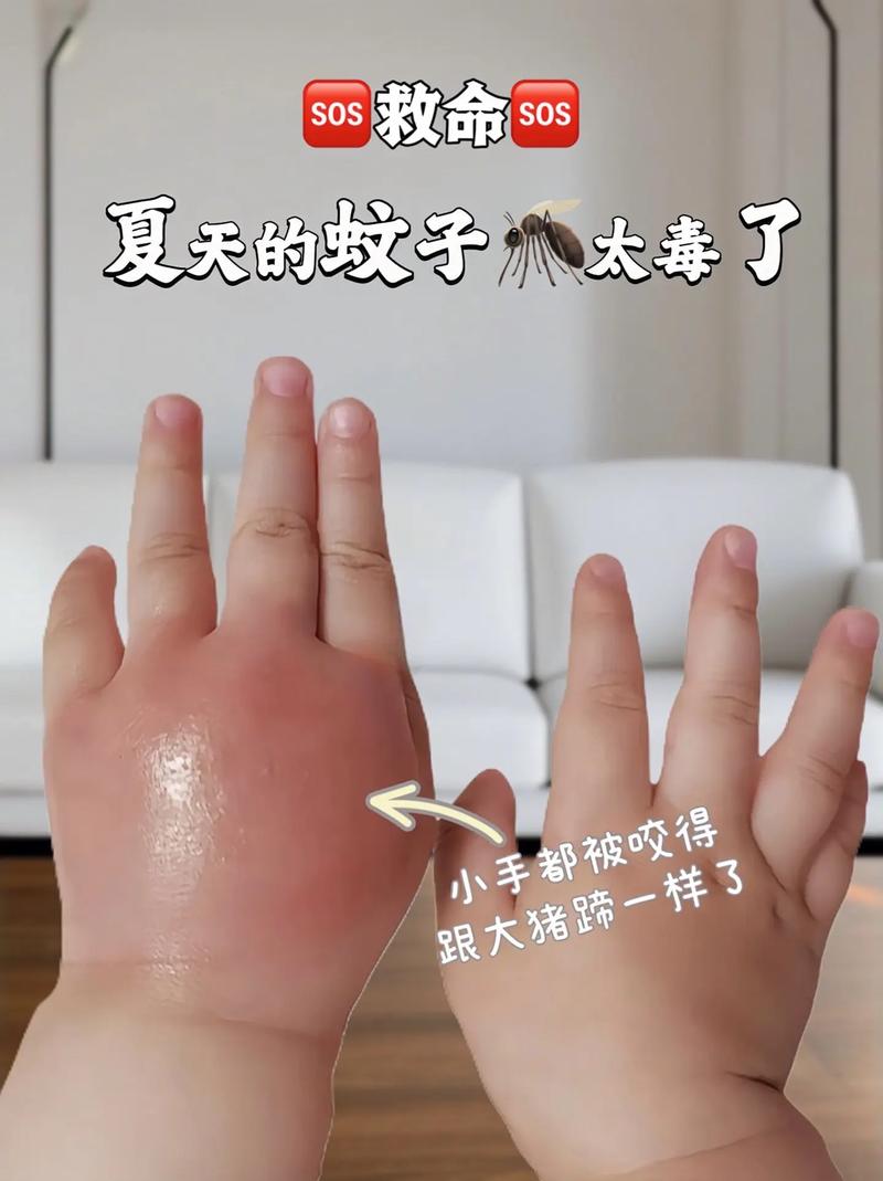 全球“最毒”的蚊子为何批量北上
