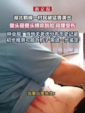 湖北一村民称遭老虎袭击 当地通报