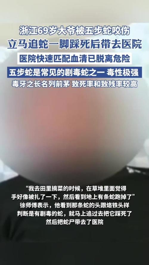 被两种蛇同时咬伤的大叔血清过敏