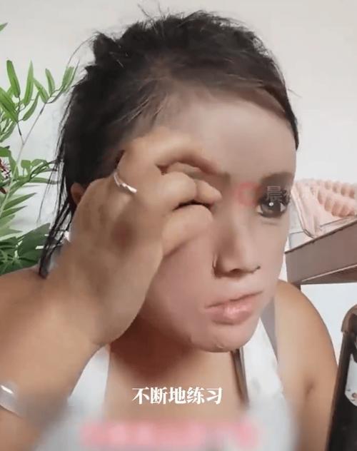 女子称逃离家暴时被泼硫酸严重毁容