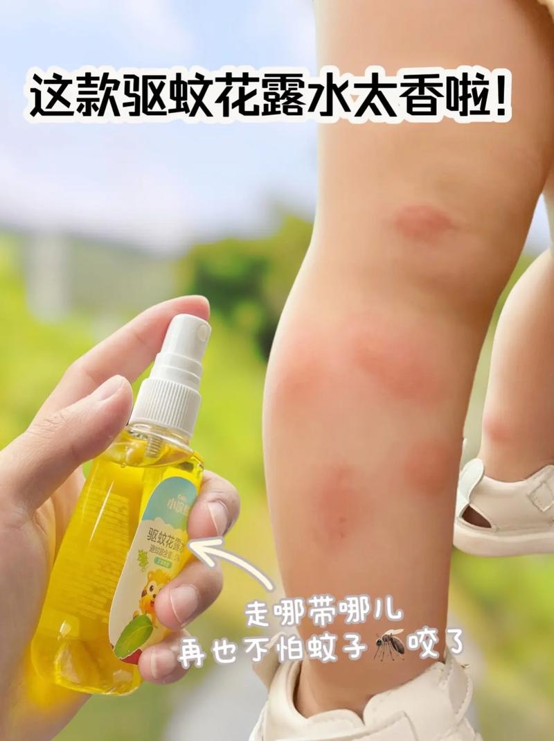 普通花露水没驱蚊效果