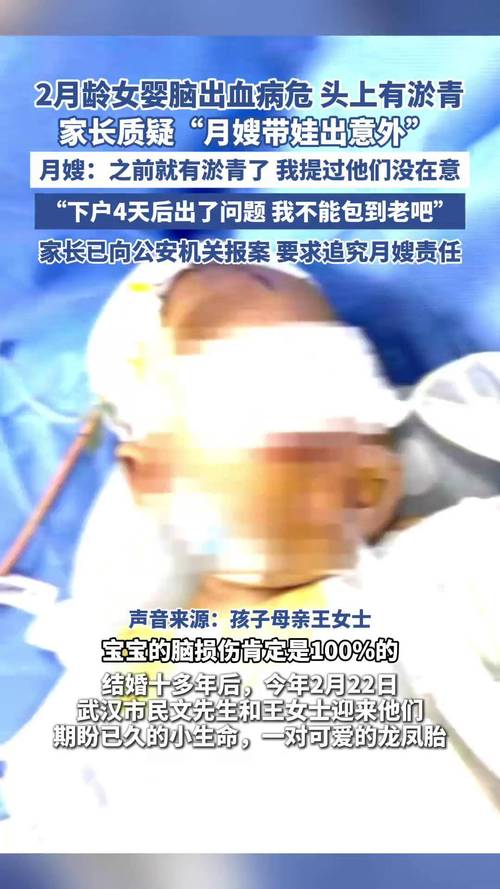 月嫂疏忽致29天婴儿重摔颅内出血