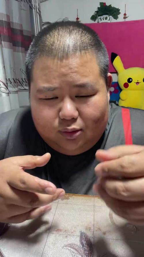 网红良子体重350多斤 胃袋占150多斤