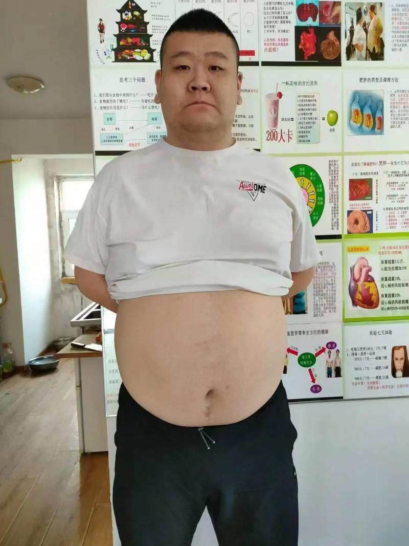 男子10年暴涨100斤半年减30斤