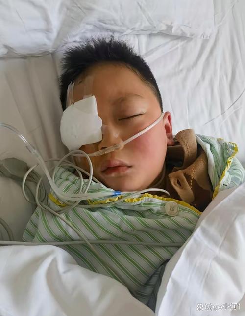 两岁男童遭灭火器直喷面部进ICU