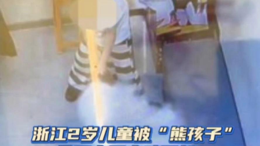 两岁男童遭灭火器直喷面部进ICU