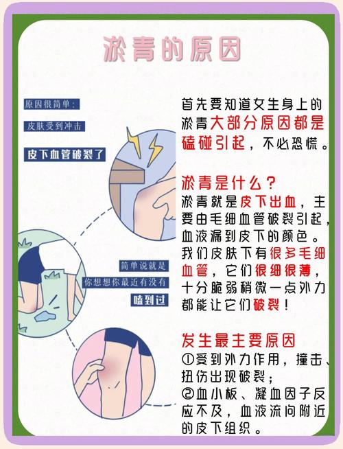 为何女生身体更容易出现淤青