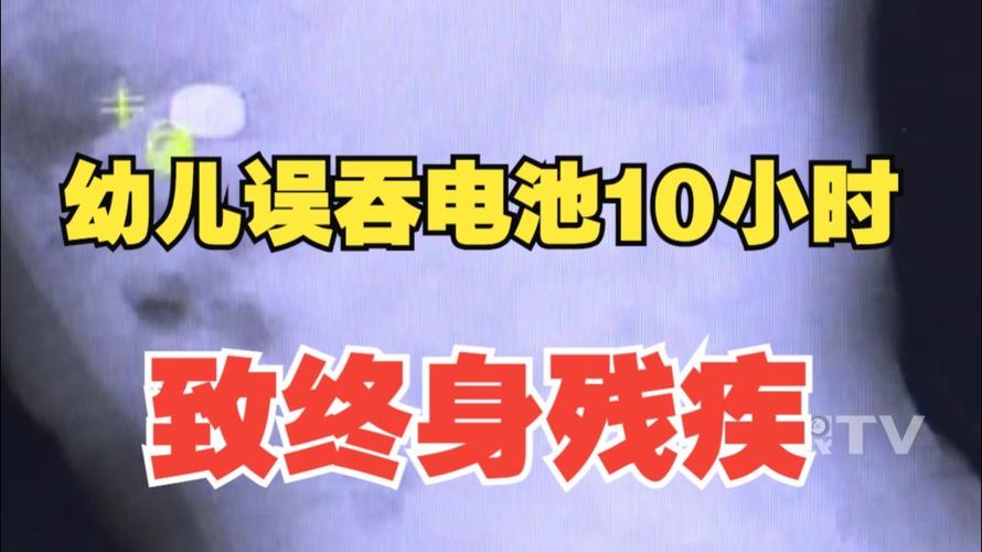 幼儿误吞电池10小时致终身残疾