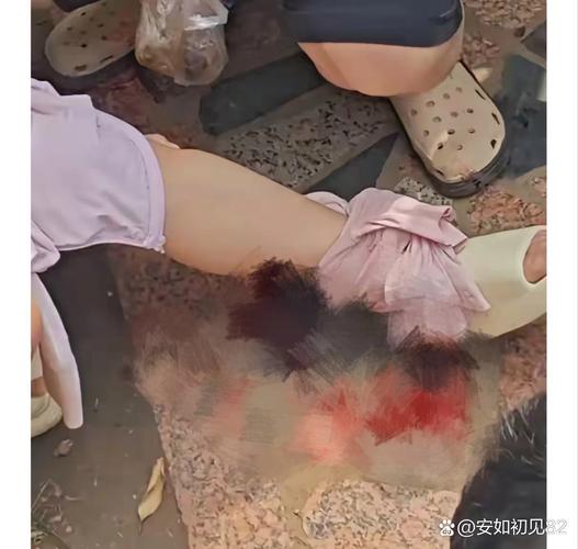 广州一动物园黑猩猩丢石块砸伤幼童