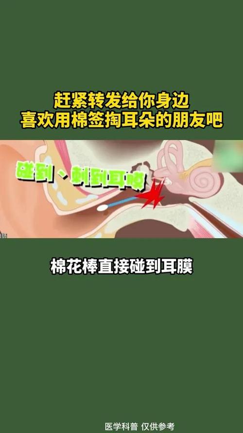 爸爸掏耳朵被孩子撞到致耳膜脱落