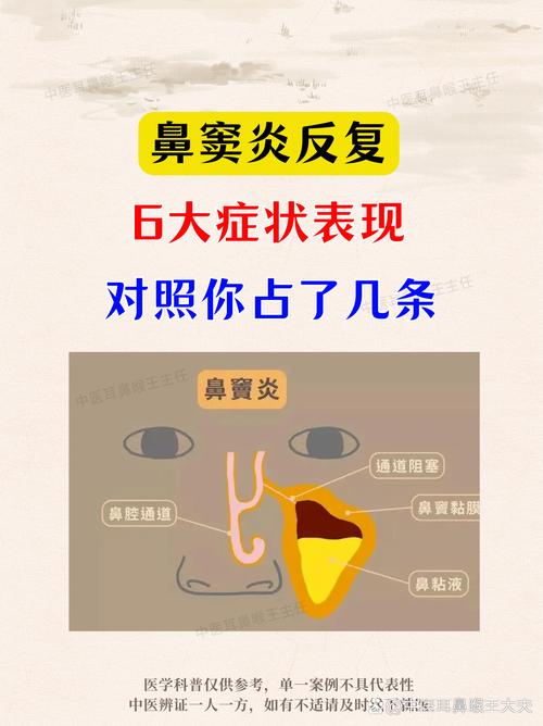 男子鼻窦炎多年竟是3厘米树枝藏鼻中