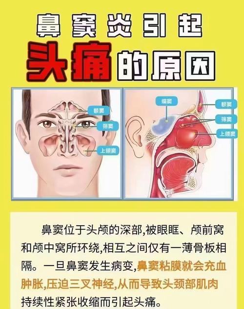 男子鼻窦炎多年竟是3厘米树枝藏鼻中