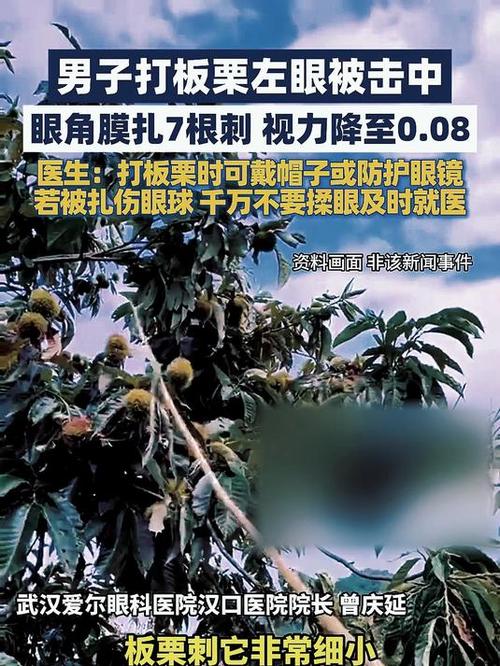 男子打板栗左眼扎入19根刺险失明