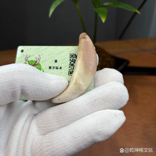 牙齿文身风靡齿科：牙冠刻印“发财”
