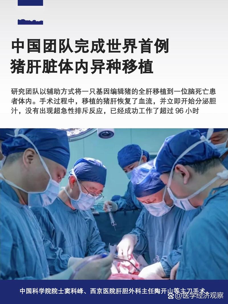 重庆完成首例成人亲体辅助肝移植