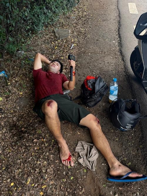 哥斯达黎加一沙滩上男子爬树坠亡