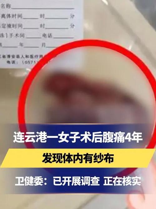 女子术后20天发现体内留纱布已发臭