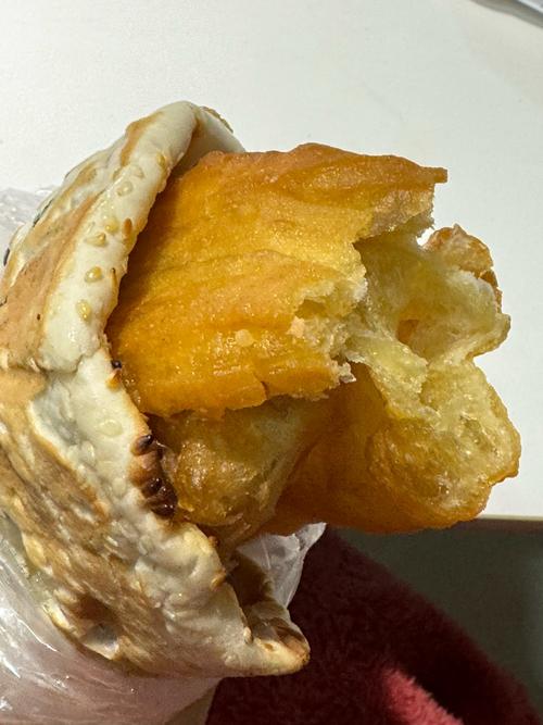 男子每早2根油条吃出动脉硬化