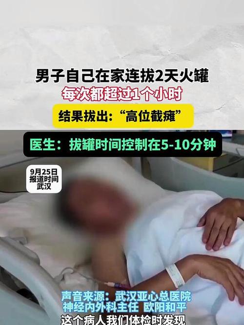 男子在家连拔2天火罐致高位截瘫