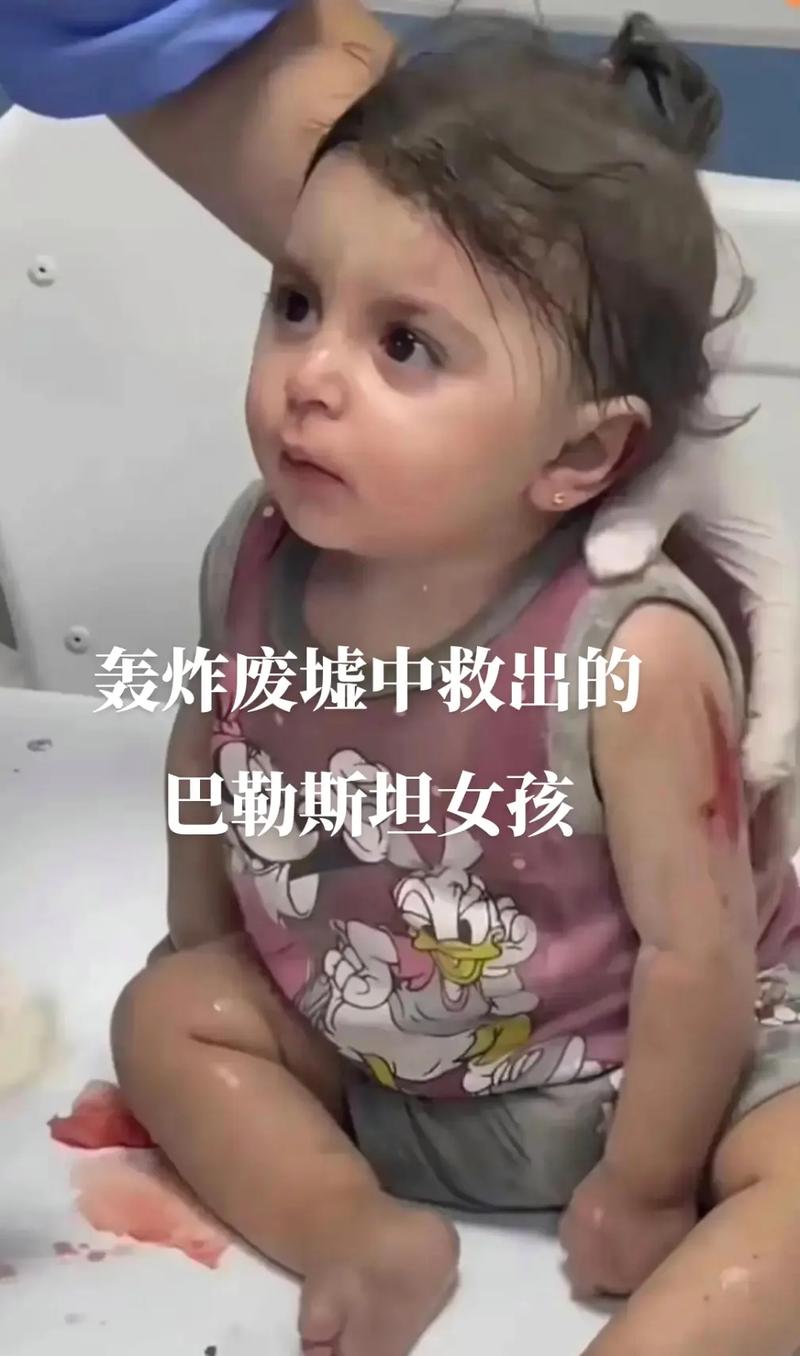 巴勒斯坦女孩废墟中被救出全身颤抖