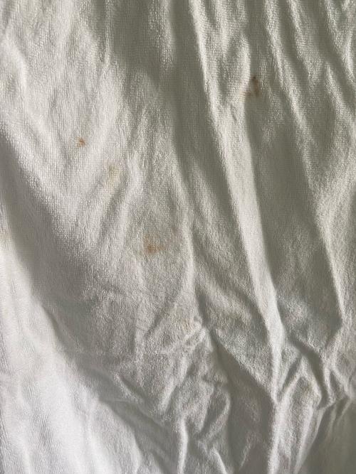 男子入住成都一酒店发现浴巾有血迹