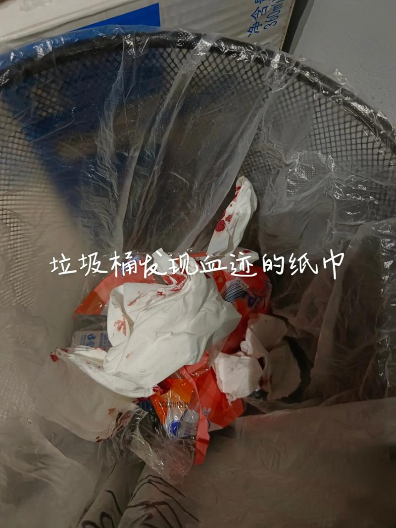 男子入住成都一酒店发现浴巾有血迹