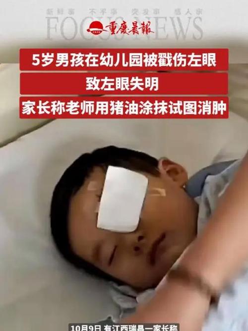 5岁男孩在幼儿园被戳伤致左眼失明