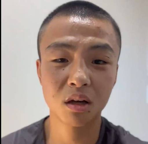 华人职业拳击手在澳大利亚遇袭