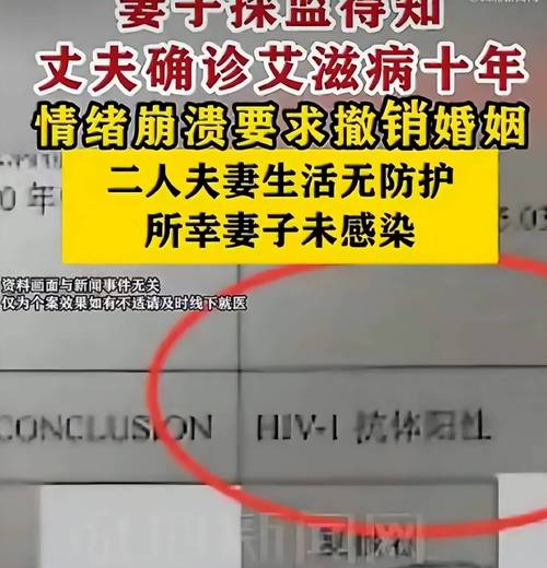 丈夫隐瞒艾滋病10年夫妻生活无防护