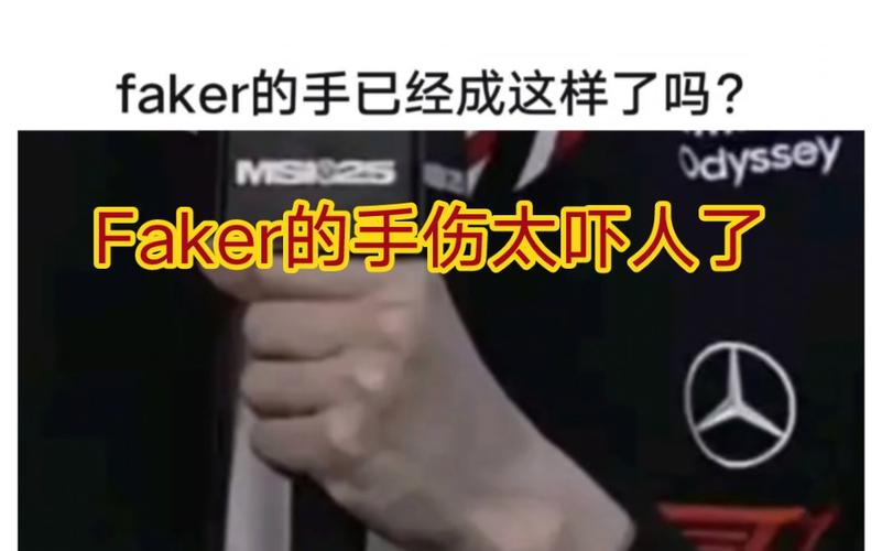 Faker谈多兰多次失误
