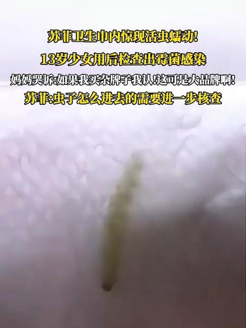 苏菲回应卫生巾上有活虫