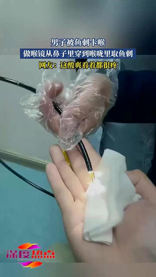 男子鱼刺卡喉后身亡工伤诉求遭驳回